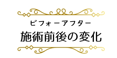 小顔矯正・骨盤矯正・肋骨矯正ビフォーアフター